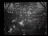 Thumbnail 30